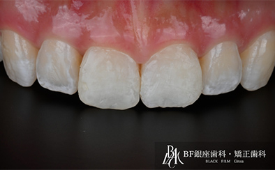 Before image
