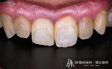 Before image