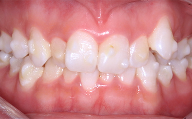 Before image