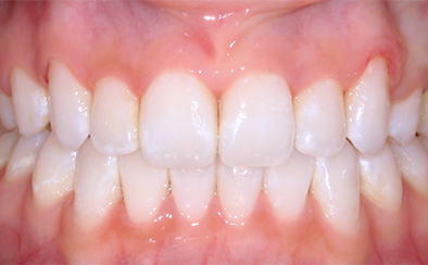 After image