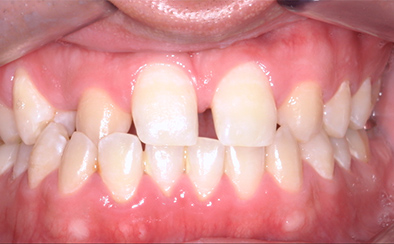 Before image