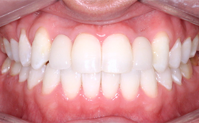 After image
