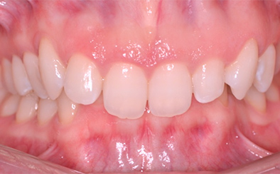 Before image
