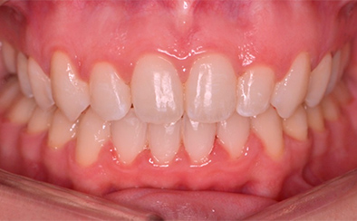 After image